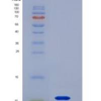 小鼠粘蛋白2(MUC2)重组蛋白
