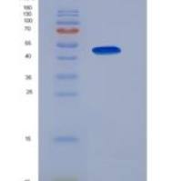 大鼠细胞色素P450氧化还原酶(CPR)重组蛋白