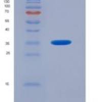 大鼠肾损伤分子1(Kim1)重组蛋白