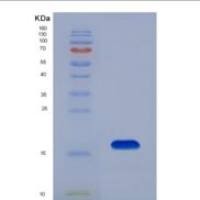 人过氧化物酶体增殖物激活受体α(PPARa)重组蛋白