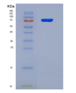 人凝溶胶蛋白(GSN)重组蛋白