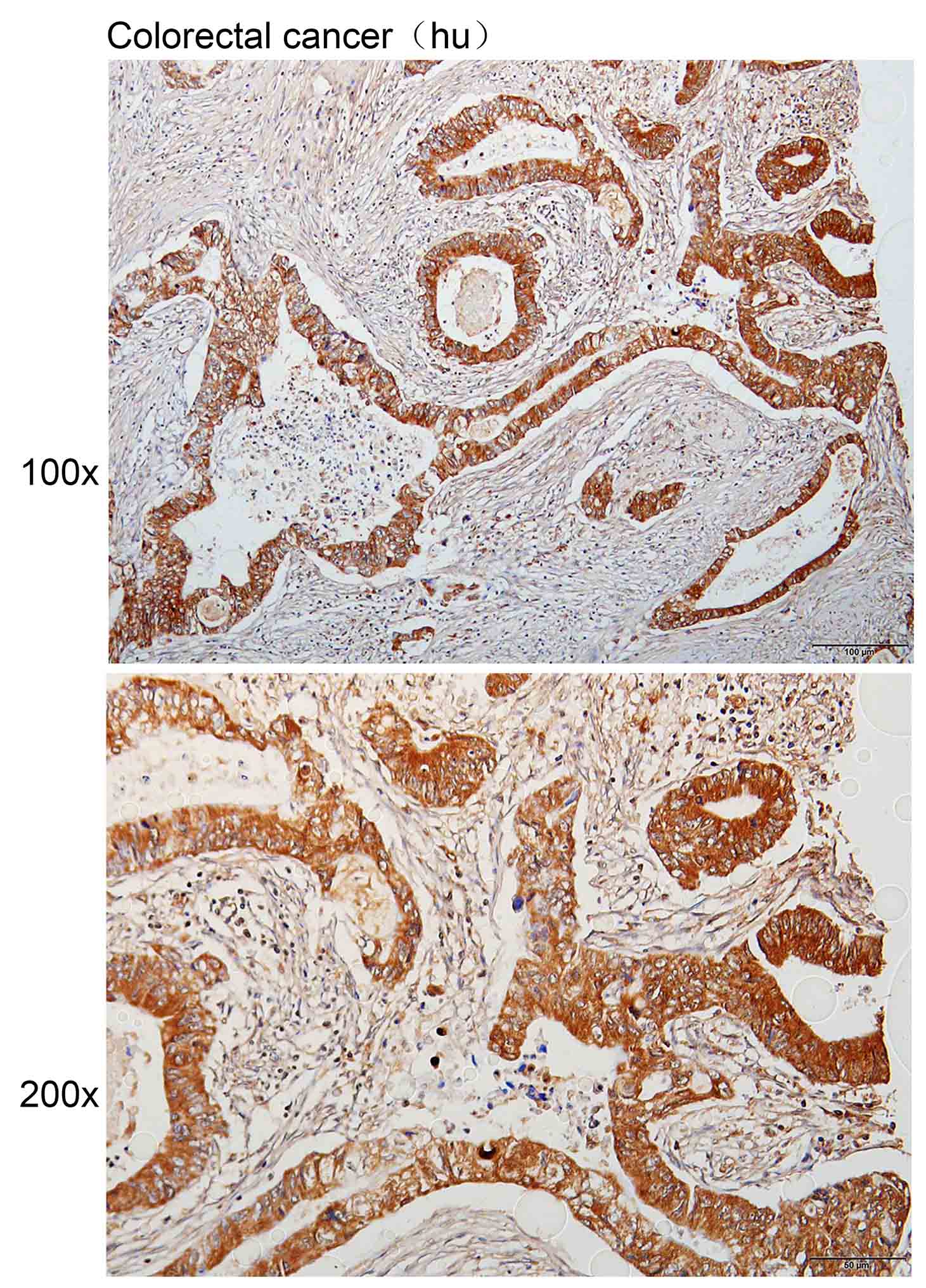 K113864P Anti-PRKAA1/PRKAA2 Po