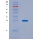 人癌胚抗原相关细胞粘附分子8(CEACAM8)重组蛋白