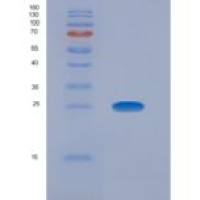 人癌胚抗原相关细胞粘附分子8(CEACAM8)重组蛋白