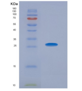 人整合素α2(ITGa2)重组蛋白