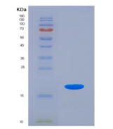 人白介素3受体α(IL3Ra)重组蛋白
