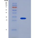 人血管内皮生长因子受体2(VEGFR2)重组蛋白