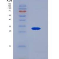 人血管内皮生长因子受体2(VEGFR2)重组蛋白