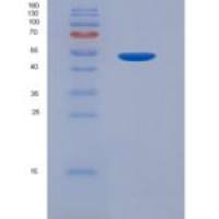 人Cereblon蛋白(CRBN)重组蛋白