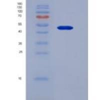 人细胞色素P450氧化还原酶(CPR)重组蛋白