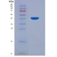 人前动力蛋白2(PK2)重组蛋白