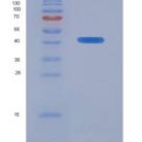 人泛素特异性肽酶8(USP8)重组蛋白