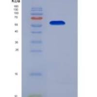 小鼠含IQ基元GTP酶激活蛋白1(IQGAP1)重组蛋白