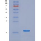 人粘蛋白5B(MUC5B)重组蛋白