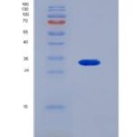 人X-脯氨酰氨肽酶3(XPNPEP3)重组蛋白