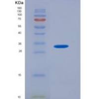 大鼠芳香烃受体(AhR)重组蛋白