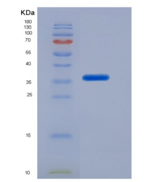 小鼠ATP结合盒转运蛋白G2(ABCG2)重组蛋白