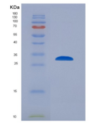 小鼠蛋白激酶,腺苷酸激活α1(AMPKα1)重组蛋白