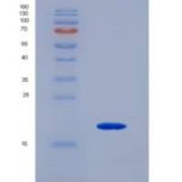 小鼠肿瘤坏死因子受体超家族成员17(TNFRSF17)重组蛋白