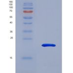 人吸引素(ATRN)重组蛋白