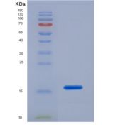 人骨膜蛋白(POSTN)重组蛋白
