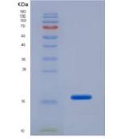 人骨膜蛋白(POSTN)重组蛋白