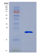 人吸引素(ATRN)重组蛋白