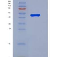 人钠尿肽受体3(NPR3)重组蛋白