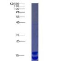 人钙卫蛋白(CALPRO)重组蛋白