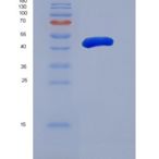 人糖原合酶激酶3α(GSK3a)重组蛋白