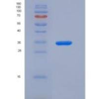 小鼠基质重塑关联蛋白5(MXRA5)重组蛋白
