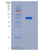 大鼠血管紧张素Ⅱ受体1(AGTR1)重组蛋白