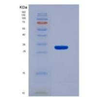 人衰老关键蛋白1(FBLN1)重组蛋白