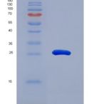 小鼠层粘连蛋白α2(LAMa2)重组蛋白