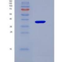 人CD1d分子(CD1d)重组蛋白