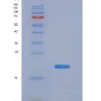 人中期因子(MK)重组蛋白