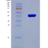 大鼠半乳糖-1-磷酸尿苷酰转移酶(GALT)重组蛋白