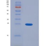 人紧密连接蛋白1(TJP1)重组蛋白