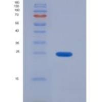 人紧密连接蛋白1(TJP1)重组蛋白