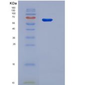 大鼠60kD热休克蛋白(Hsp60)重组蛋白