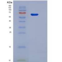 大鼠60kD热休克蛋白(Hsp60)重组蛋白