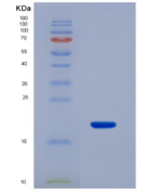 大鼠脂肪酸结合蛋白 4(FABP4)重组蛋白