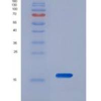 小鼠血管活性肠肽受体1(VIPR1)重组蛋白