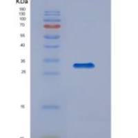 人KSP钙黏蛋白(CDH16)重组蛋白