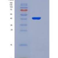 人鞘磷脂脂质蛋白1(PLP1)重组蛋白