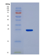 人琥珀酸脱氢酶复合体B亚基(SDHB)重组蛋白