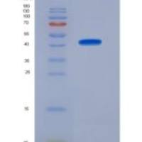 大鼠脯氨酸-4-羟化酶α多肽Ⅰ(P4Ha1)重组蛋白