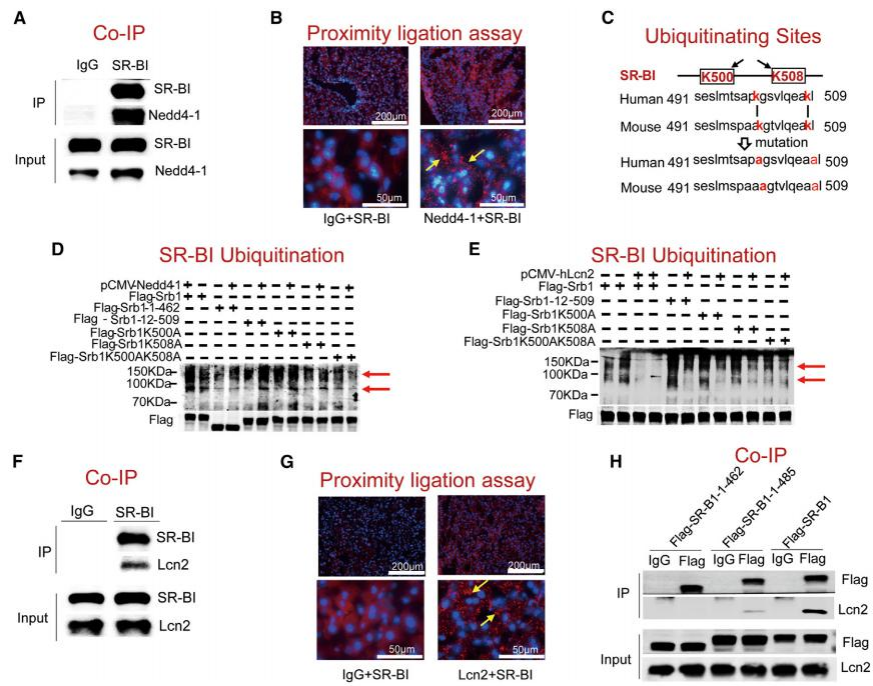 复旦大学徐延勇等团队发现动脉粥样硬化的关键调节因子