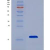 人围脂滴蛋白4(PLIN4)重组蛋白