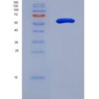 人肽基精氨酸脱亚氨酶Ⅱ(PADI2)重组蛋白